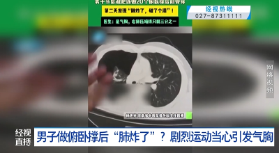 男子做俯卧撑后“肺炸了”？剧烈运动当心引发气胸