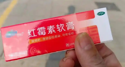 红霉素软膏千万不能随便用！赶紧告诉家里人