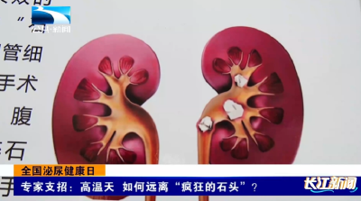 专家支招：高温天 如何远离“疯狂的石头”？