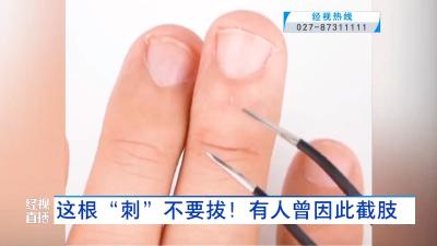 这根“刺”不要拔！有人曾因此截肢