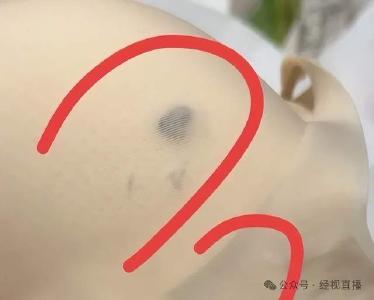 知名品牌内衣里惊现虫子？品牌方：出厂质检不可能检查不出，疑似同行恶意搞事 ！市监局回应