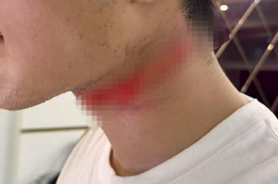 男主播骑车载女友回家被路边掉落网线勒伤脖子，索赔3万陷僵局 律师解读该谁赔