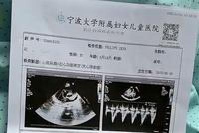 浙江宁波5月龄女婴手术后离世 官方通报：已成立调查组