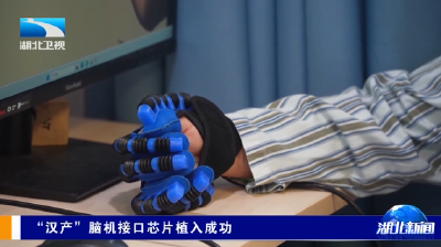 “汉产”脑机接口芯片植入成功