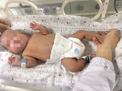 出生仅650克！一路“闯关”80余天，“迷你天使”康复出院