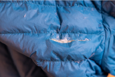 羽绒服“漏绒”致呼吸衰竭！医生：警惕“羽绒肺”