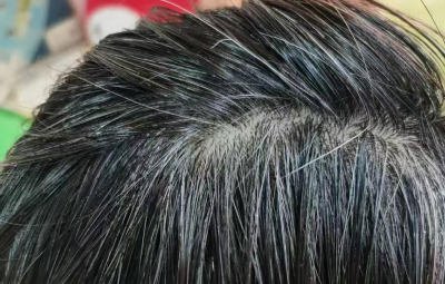 “逆转白发”产品五花八门 专家：不如好好吃饭睡觉