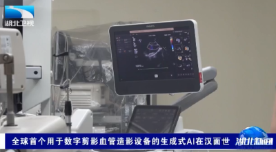 全球首个用于数字剪影血管造影设备的生成式AI在汉面世