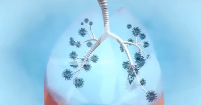 6岁女童持续高烧17天，脑子被“啃”了十多个“洞”！真凶竟是生活中随处可见的它