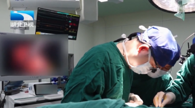 全球首例腔镜辅助小切口心脏移植手术在武汉完成