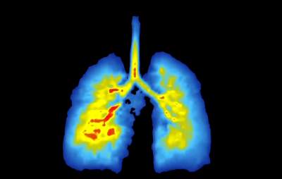 问计2026 对话代表委员丨周欣：十五年磨砺 点亮生命之树