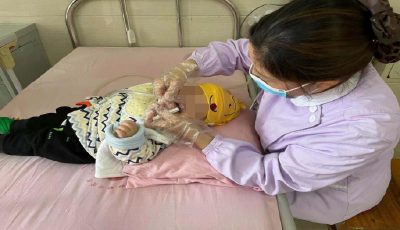 县保健院：开展鼻负压置换治疗  深受家长欢迎