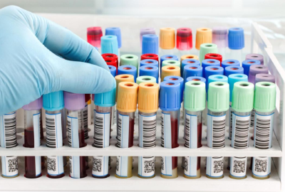 房县新增新冠病毒抗原检测纳入医保核销范围