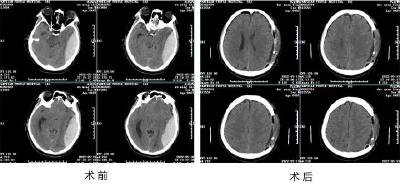 县医院优质服务在行动——以病人为中心 两科联手为急危患者重启生命键