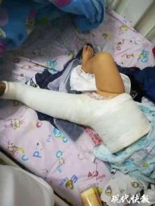 7个月大婴儿被狗撞成十级伤残，狗主人拒赔玩失踪