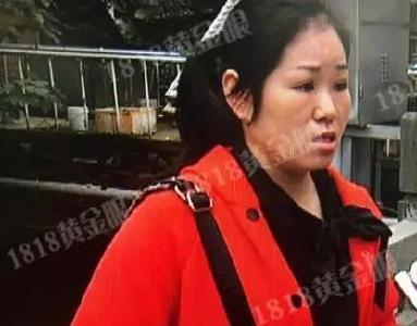 女子整形后上班遭拒 老板娘:别来了太吓人