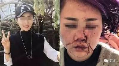 丽江遭暴打女子：治疗花光积蓄 没钱请律师了