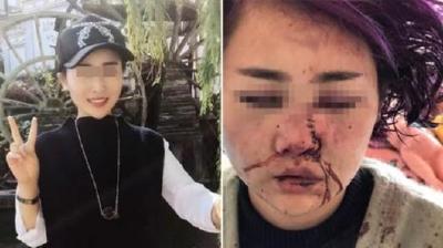 官微转发指责被打女游客放荡文章 丽江警方回应