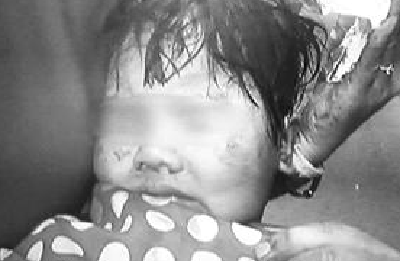 天降砖头把2岁女童砸成重伤 法院判18个住户一起赔