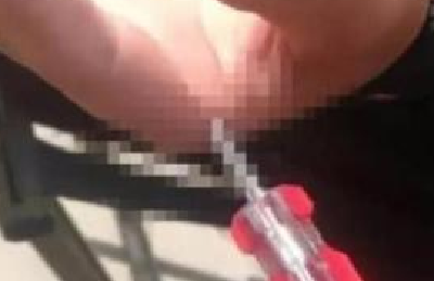 扎心！外卖小哥遭遇高空抛物 螺丝刀插入手掌8厘米