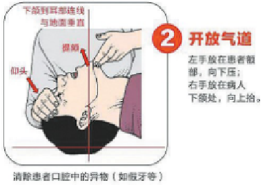 我国每年55万人因为ta猝死！十堰人，看了这个能救命