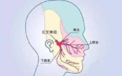 七旬老人被三叉神经痛折磨多年 经太和医院开展微血管减压术后解除