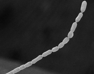 科学家发现2厘米长巨型细菌 比普通细菌大5000倍