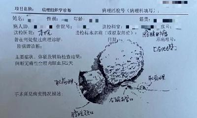 外科医生手绘病理标本走红，本人回应：10分钟就能画一张