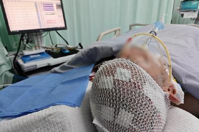 太和医院床旁长程脑电监测 起底癫痫病灶让患者更好康复