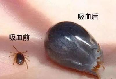 病死率高达20%！“五一”出游谨防蜱虫叮咬，预防指南来了