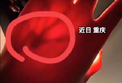 女生晒照被网友提醒有“瘤”？真的救命了！医生回应……