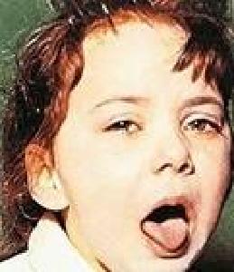 咳嗽最忌乱吃药：胡乱止咳感染加重 随意抗炎细菌耐药