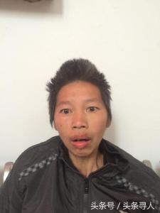 中年女子在荆州被救助，急寻家属！疑似智力障碍