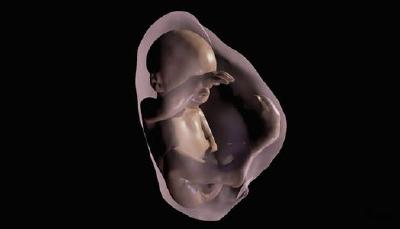 VR+磁共振 让准爸妈“瞅瞅”未出生的宝宝