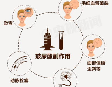 有人注射后瞬间失明！“驻颜神器”玻尿酸到底安全吗？ 