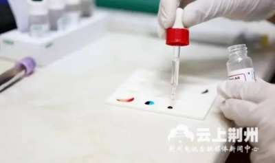 释疑丨艾滋病疫苗真的已经来了？事情没那么简单！ 