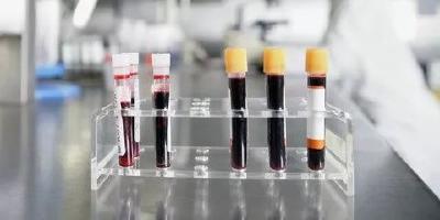 11月22日 云上新闻十点半