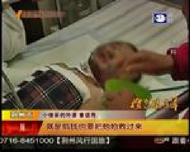 烧伤男童小俊豪出院回家了
