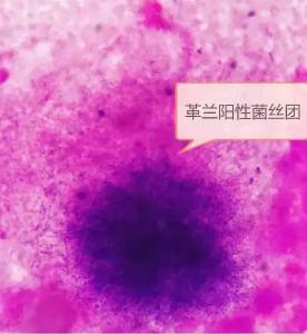 提醒丨他摸了出土文物，然后住院八次