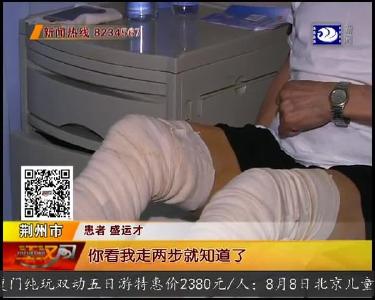 久站久坐要注意 警惕 “美腿杀手” 静脉曲张