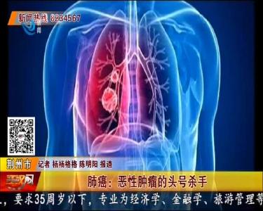 肺癌：恶性肿瘤的头号杀手
