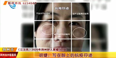 2020年度荆州好人丨胡捷：写在脸上的抗疫印迹