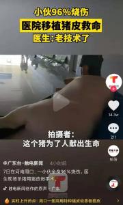 小伙全身96%烧伤，医生移植猪皮救命！现场杀了一头猪！