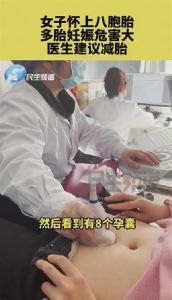 郑州女子怀上八胞胎  医生建议减胎