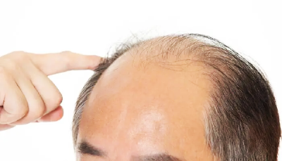 一年之计在于春，“头”等大事，你还不急？
