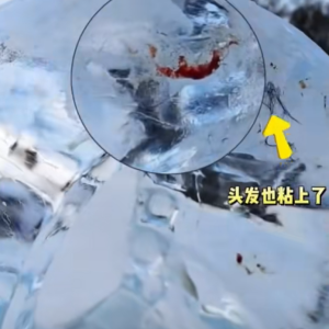“全是嘴唇血印”，千万别试！医生紧急提醒