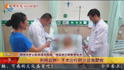 荆州首例!手术治疗阿尔兹海默病