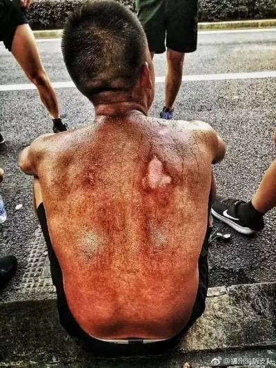 朋友圈被一张背影照刷屏！这才是真正的英雄！