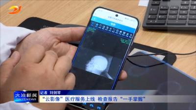 “云影像”医疗服务上线 检查报告“一手掌握”