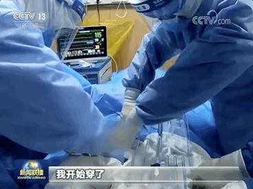 惊心动魄！《新闻联播》实拍ECMO救治新冠肺炎危重症患者全过程......